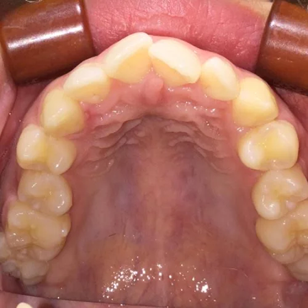 キレイハ岡山院の症例実績1