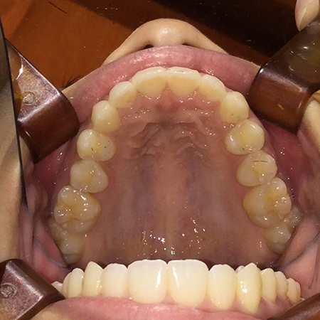 キレイハ岡山院の症例実績2