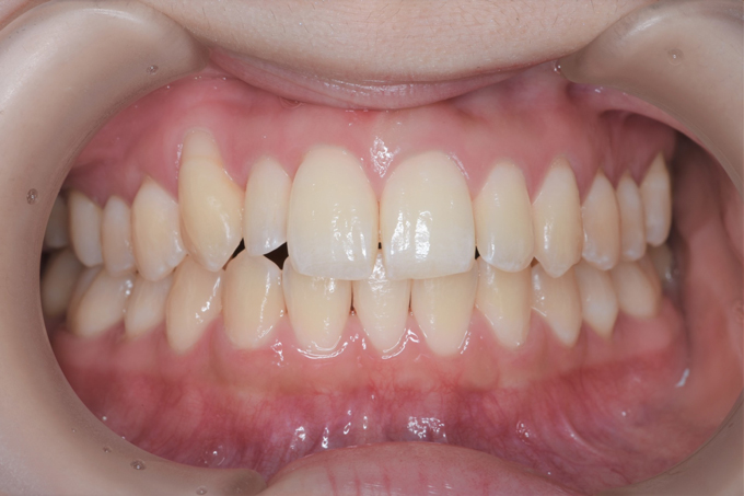 田中矯正歯科医院の症例実績2